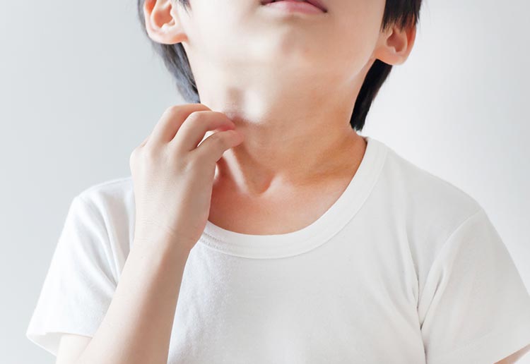 子どもの肌トラブルの原因イメージ画像